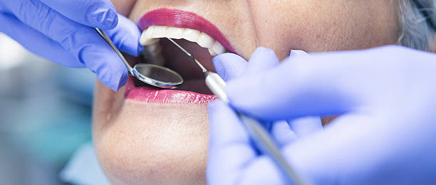 Best Emergency Treatment for Dental Infections or Abscesses in Hildebran, NC