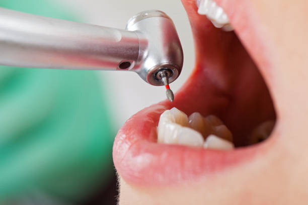 Best Same-Day Emergency Dental Services in Hildebran, NC